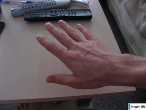 Red and bald. Family album. Part 2. Thumbnail 12