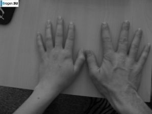 Red and bald. Family album. Part 2. Thumbnail 9