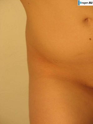 Archive of a Fat Girl. Part 4. Thumbnail 26