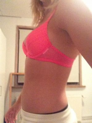 Acne selfie. Thumbnail 14