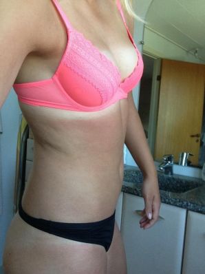 Acne selfie. Thumbnail 22