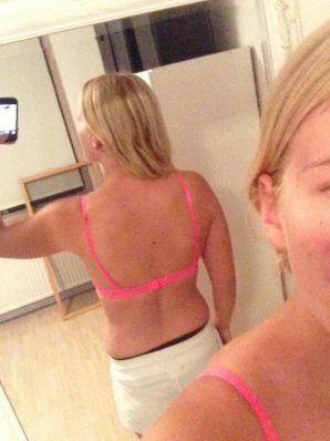 Acne selfie. Thumbnail 32