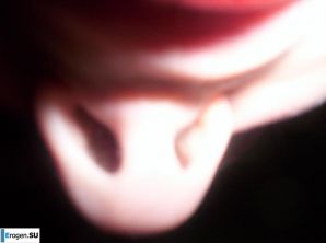 Dark-eyed Gray-Eye. Thumbnail 10