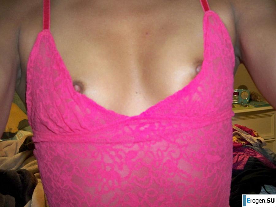 silicone boobs. Part 8. Slide 42