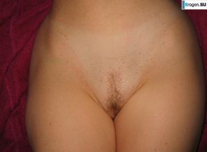 red-haired cauliflower slim woman. Thumbnail 36